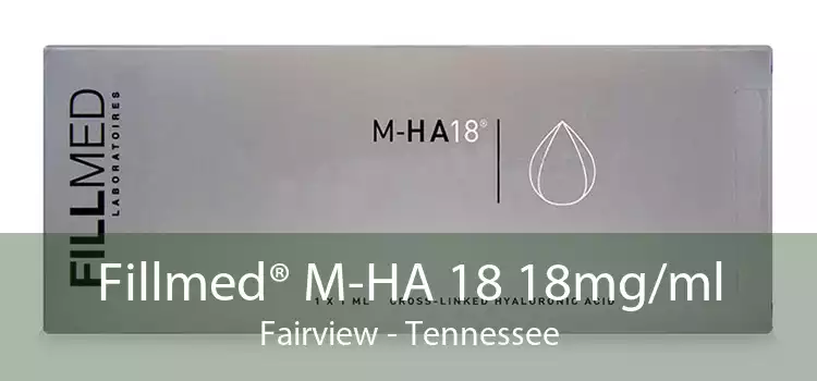 Fillmed® M-HA 18 18mg/ml Fairview - Tennessee