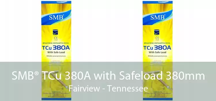 SMB® TCu 380A with Safeload 380mm Fairview - Tennessee